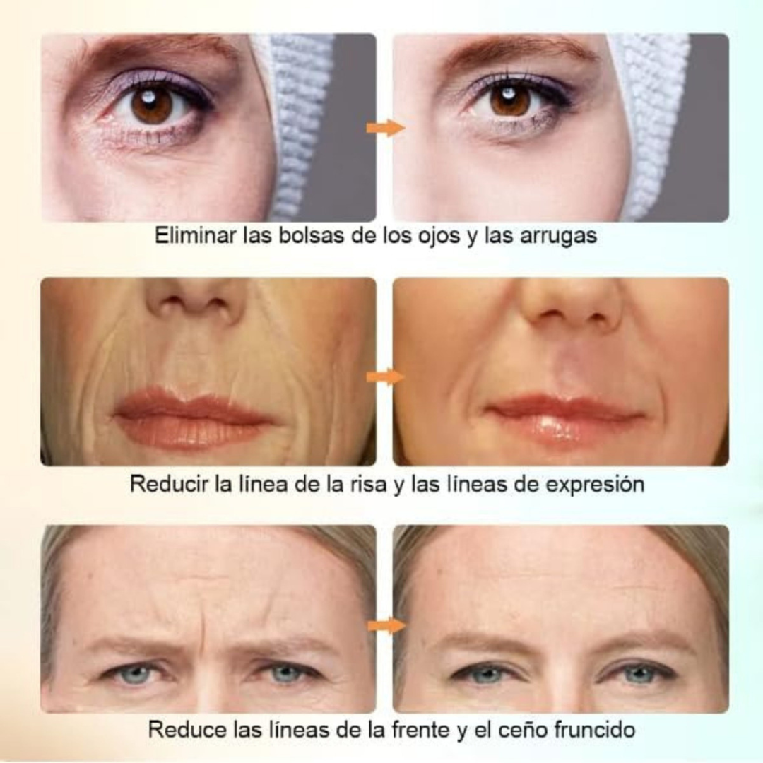 Masajeador Facial - Rejuvenece tu rostro desde casa con tecnología EMS y despídete de las arrugas